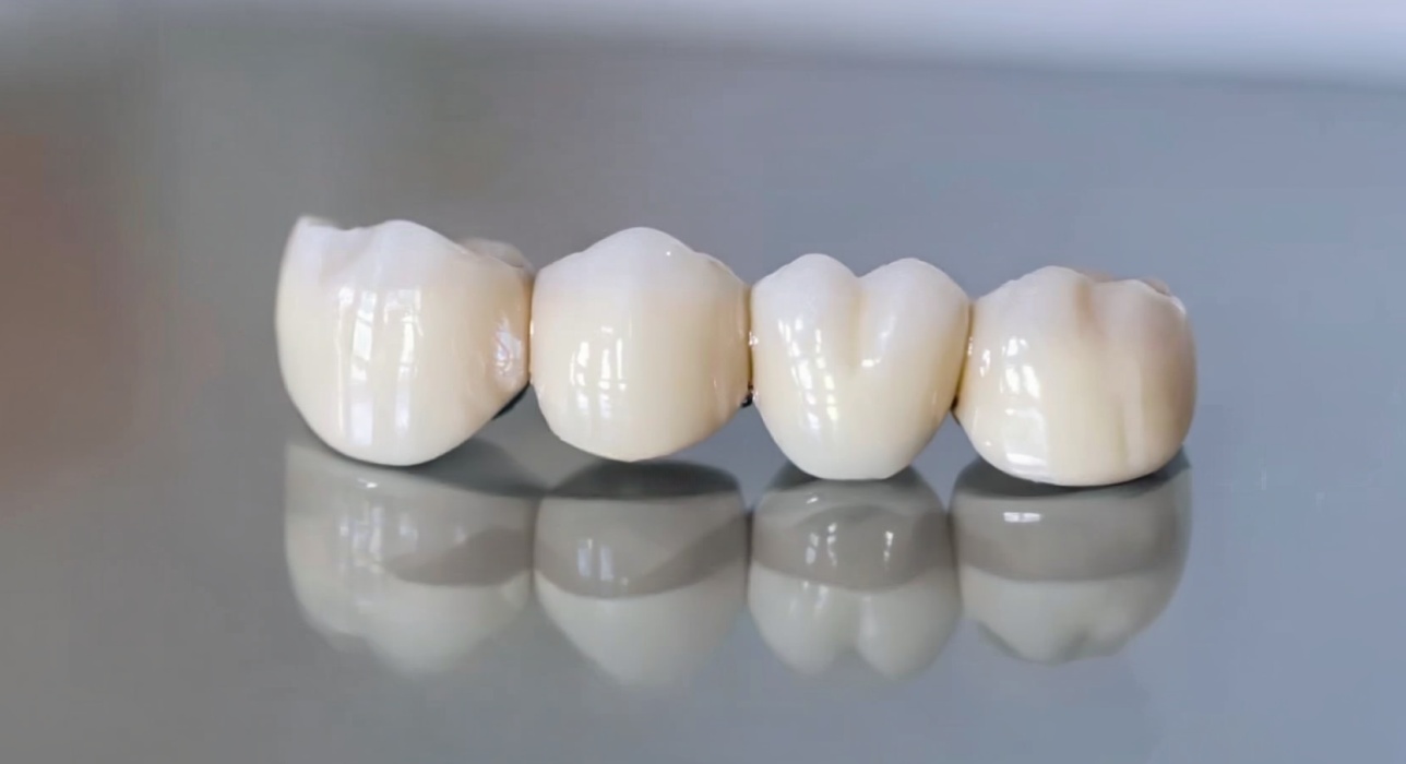 Dental Bridges in Kettering