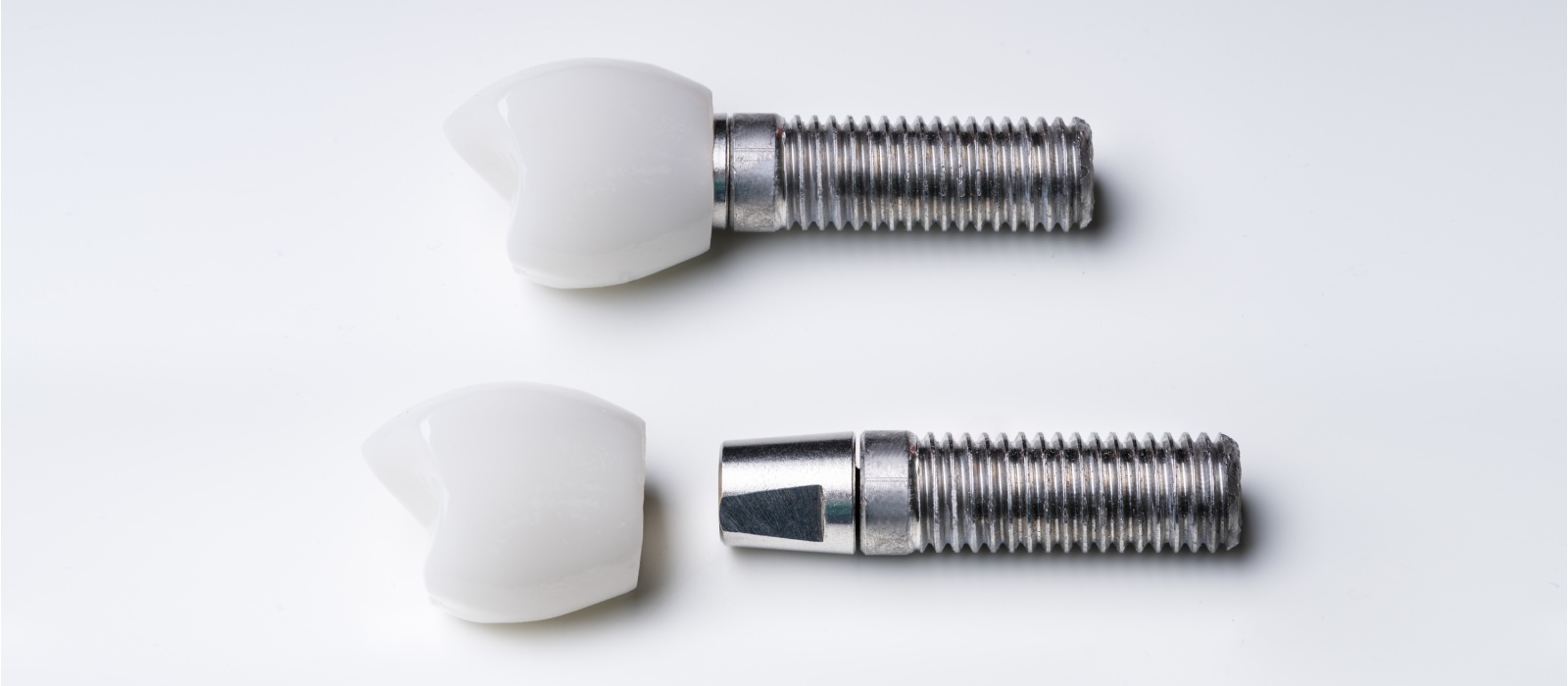 Expert Dental Implants Kettering, Ohio