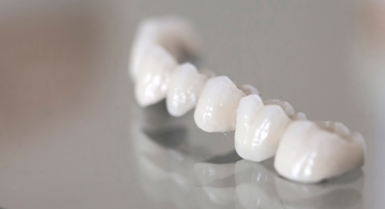 Porcelain Crowns in Kettering, OH