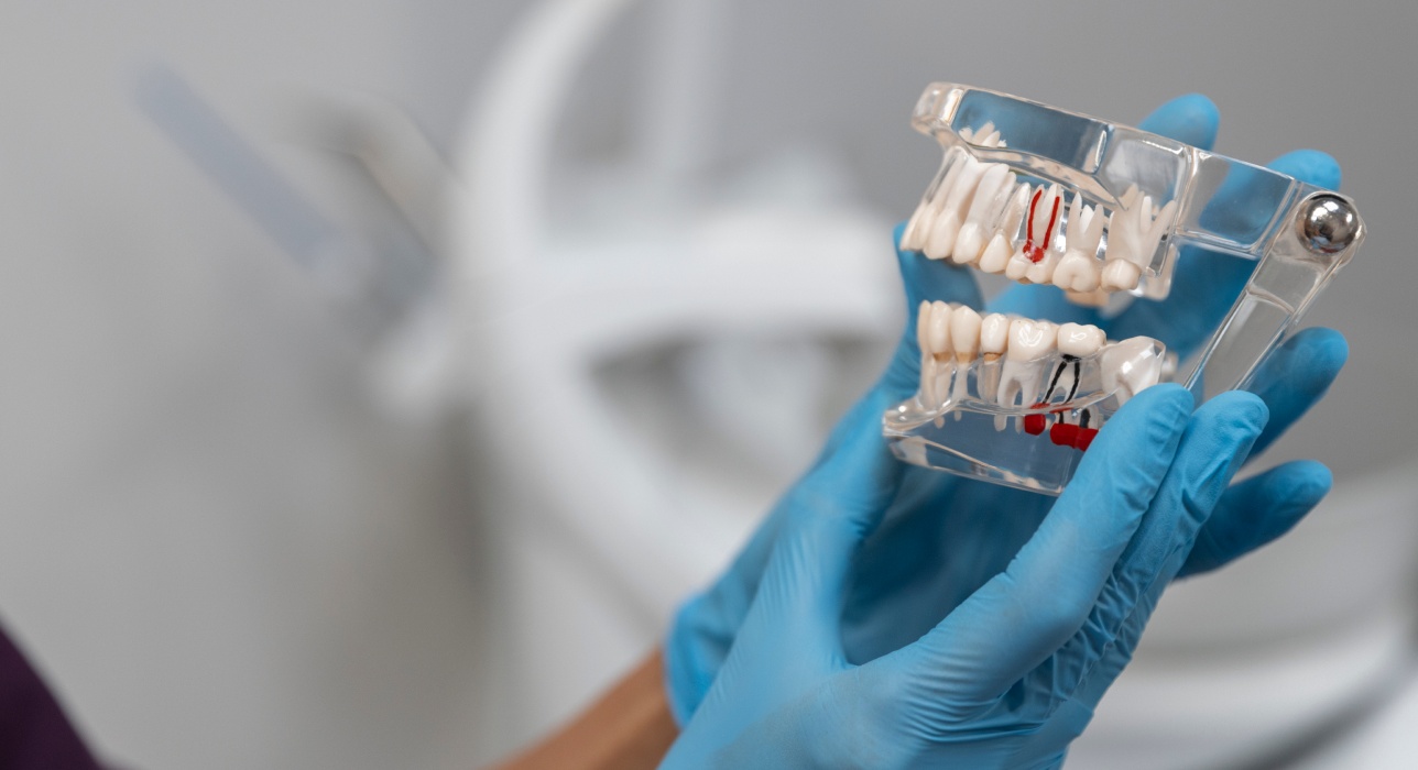 Root Canal Treatment in Kettering, OH